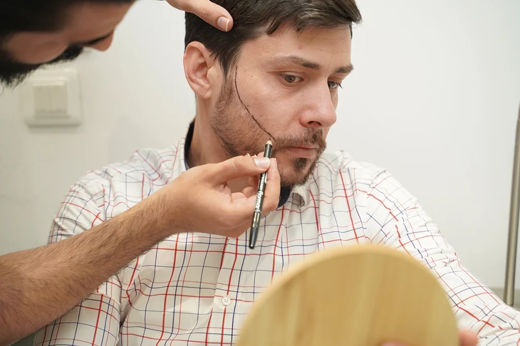 Трансплантација на брада во Vatanmed.